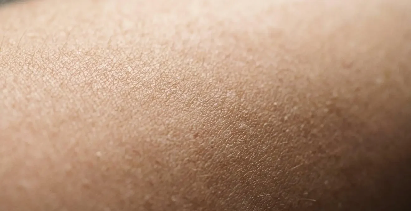 Close detail of darkened skin texture showing hyperpigmentation pattern associated with metabolic dysfunction