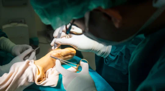 Surgeon performing minimally invasive foot surgery in a modern operating room.